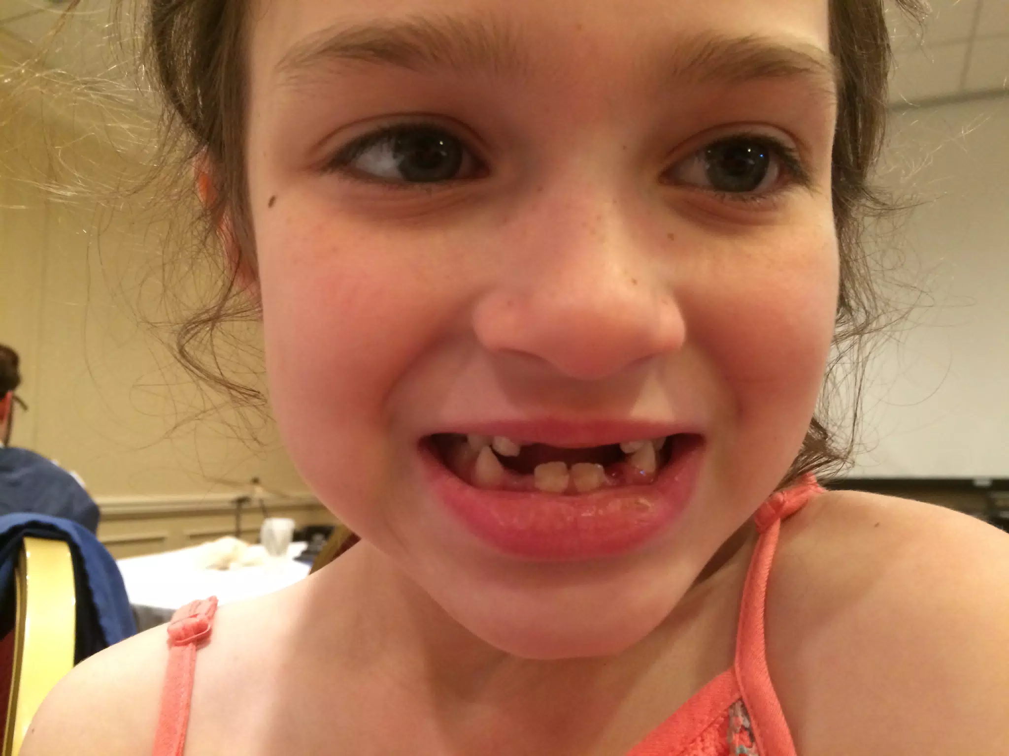 Liesl Has Lost Four Teeth at Once