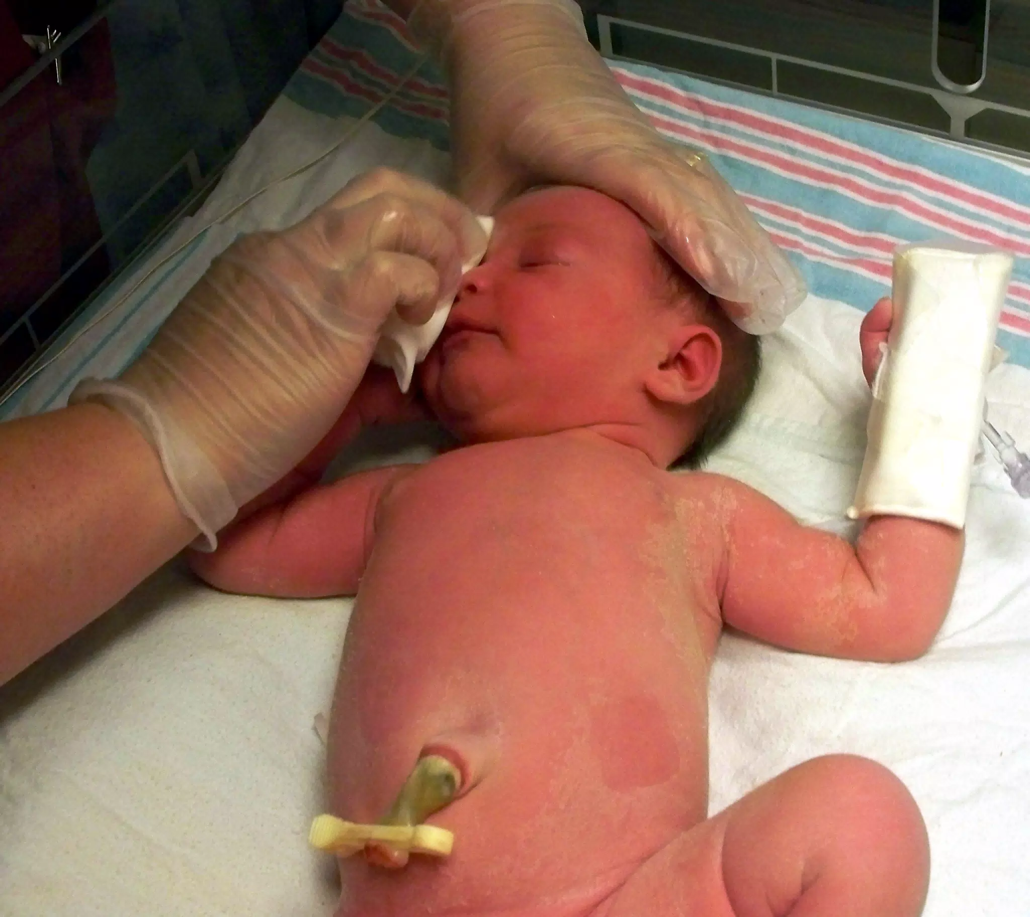 Liesl Starting Her First Bath with Nurse Lisa