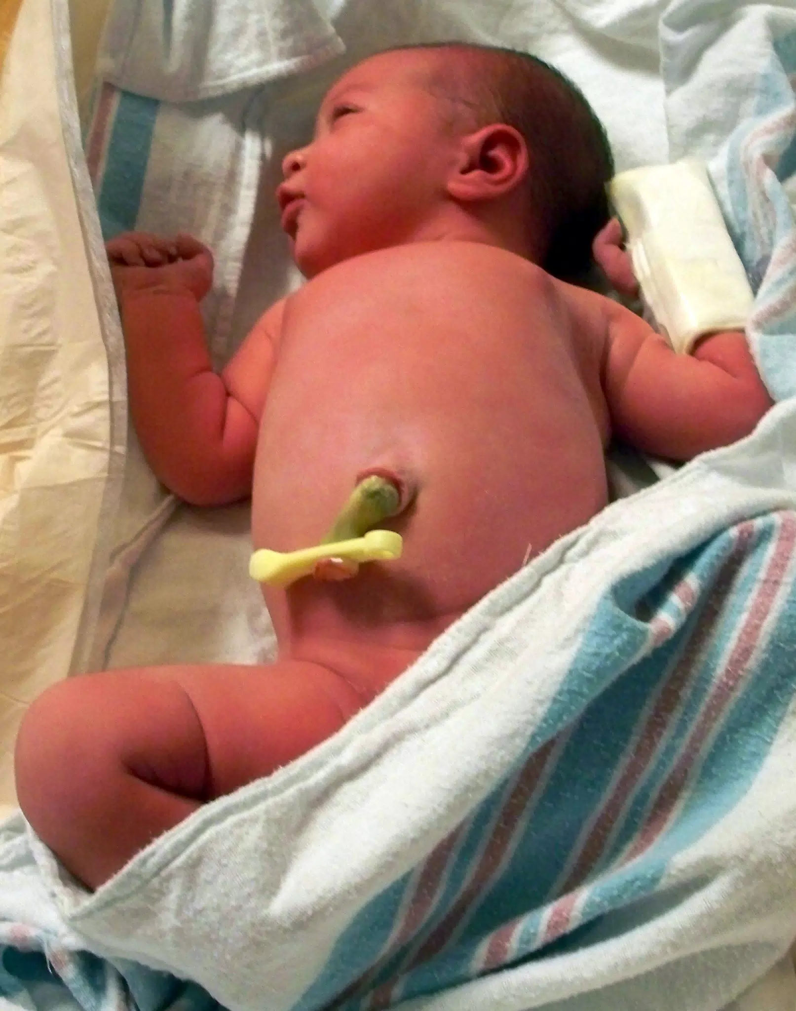 Liesl Finally Gets to her Bassenette and Swaddling