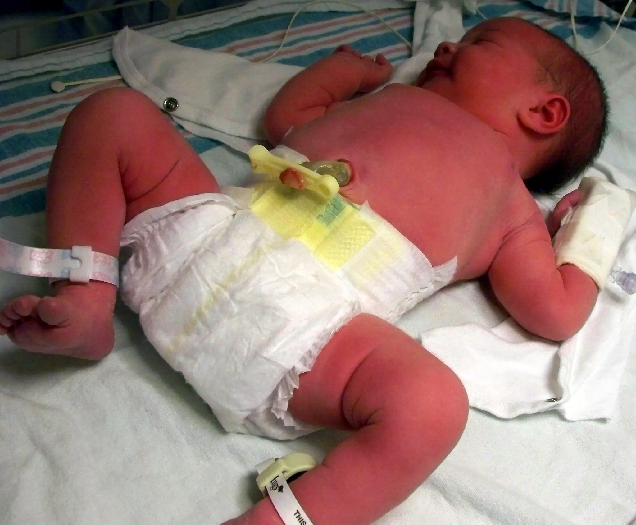 Liesl In Her First Diaper