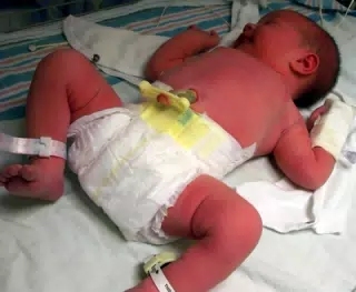 Liesl In Her First Diaper