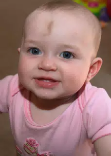 Liesls First Two Teeth