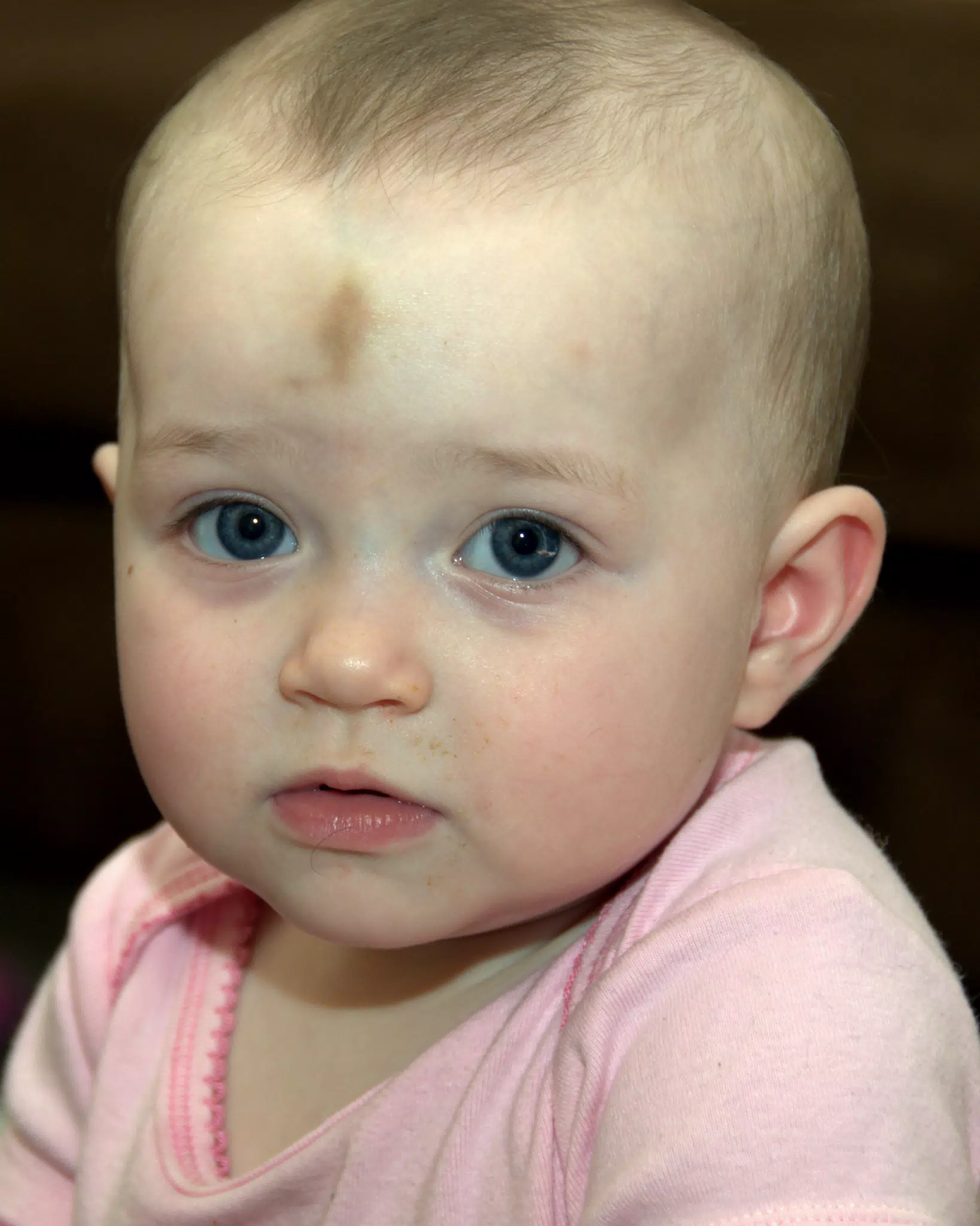 Liesl Has a Bump on Her Noggin