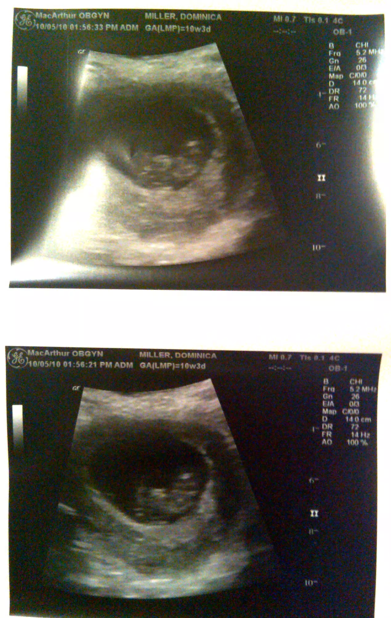 Announcing...