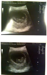 Announcing...