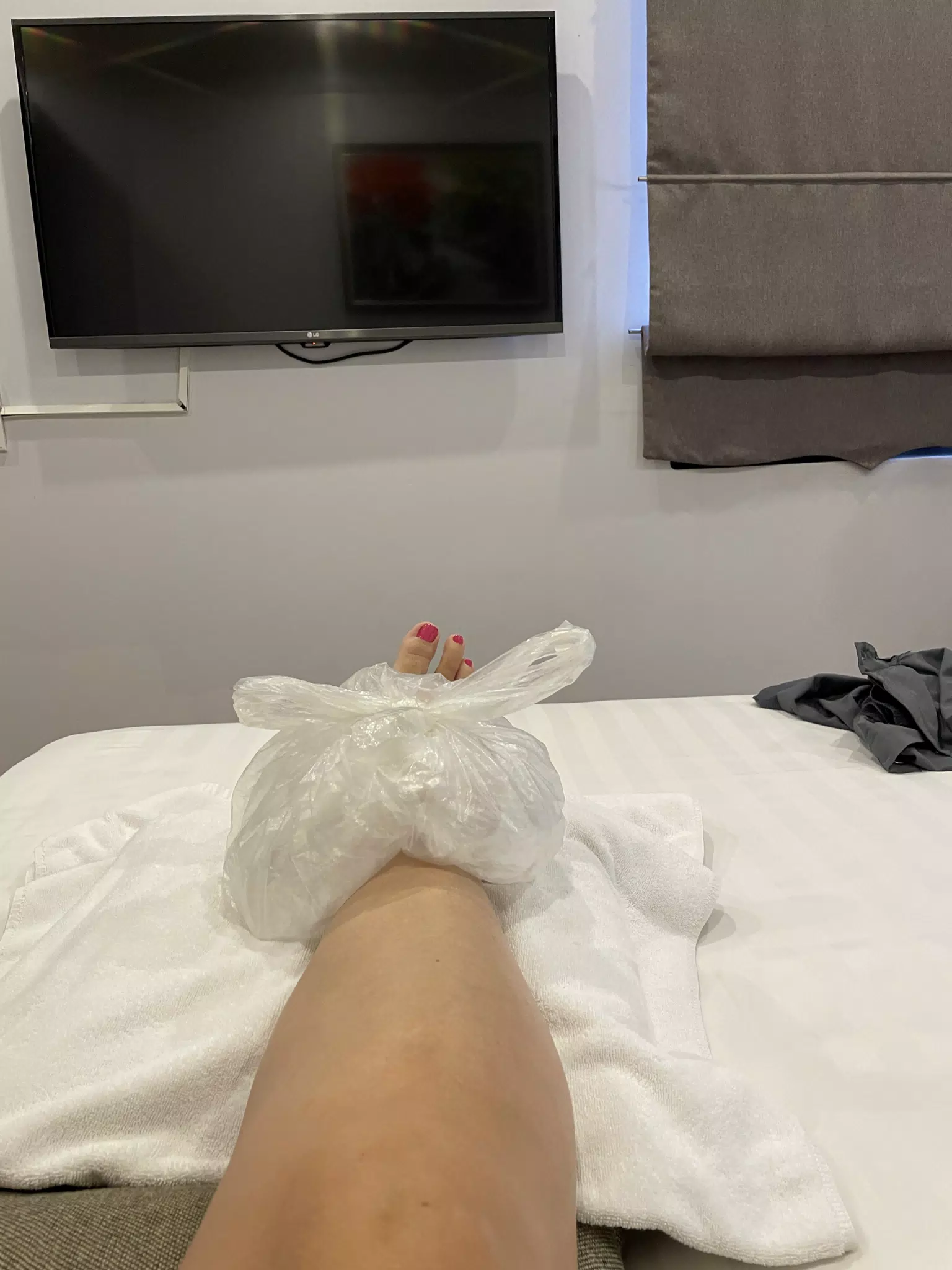Sprained Ankle in Vietnam