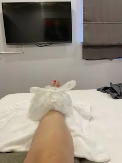 Sprained Ankle in Vietnam
